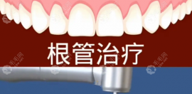 根管治疗第二次钻心疼/疼得要死为什么?第三次还会不会痛呢