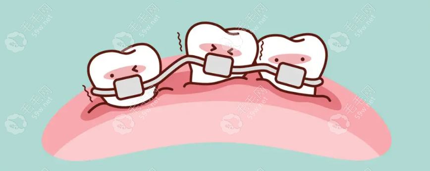 梧州口腔医院牙齿矫正多少钱