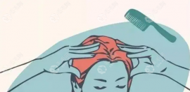 做雾化控油治疗的作用是什么?这种头皮疗法能辅助治疗脱发