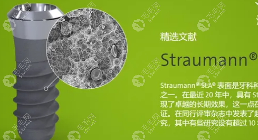 straumann种植体种类 毛毛网