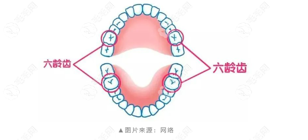 六龄齿窝沟封闭一颗牙多少钱?100-200元起/不用长一颗做一颗