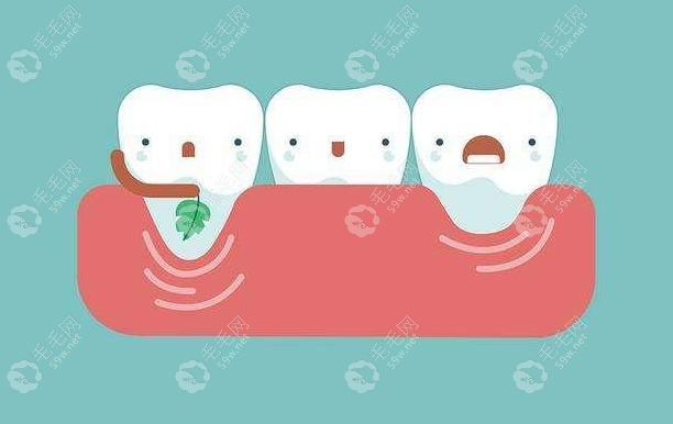 牙齿囊肿手术是大手术还是小手术