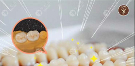 根管治療后全瓷牙套一顆多少錢?便宜點(diǎn)國(guó)產(chǎn)全瓷冠價(jià)格1200起