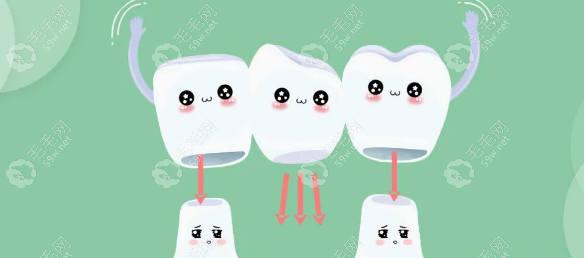 烤瓷牙修复牙齿 59w.net