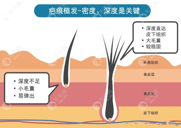 开颅手术留下的疤痕一般不会长出头发59w.net