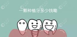 曲靖種植牙多少錢(qián)一顆2025?多家好的醫(yī)院在集采后降價(jià)至1980+