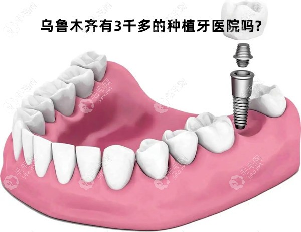 乌鲁木齐有3千多的种植牙医院吗