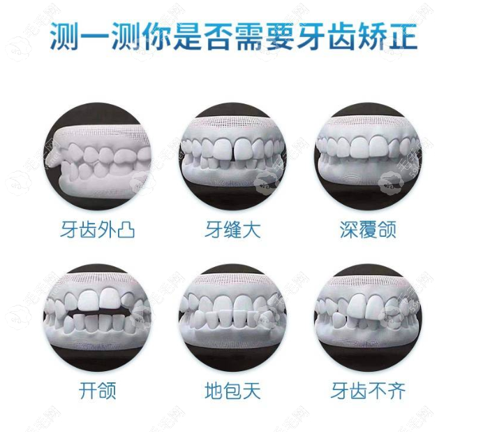 禾禾齿科价格比公办医院贵吗