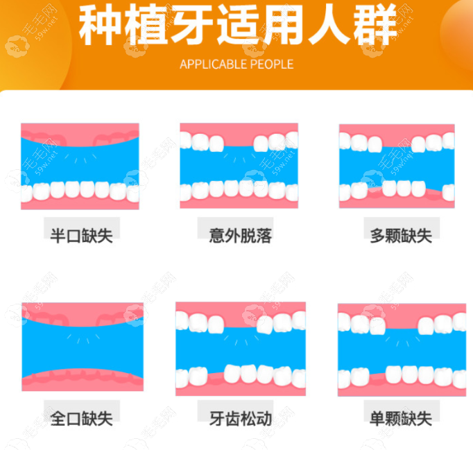 中诺口腔科种植牙质量怎么样