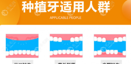 中诺口腔科种植牙质量怎么样?中诺种牙靠谱且民众评价好