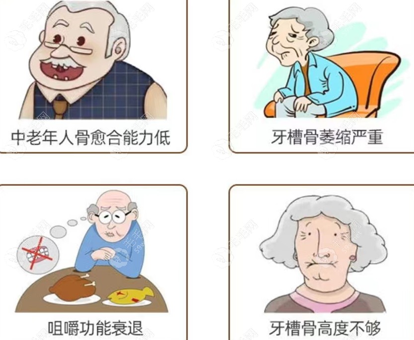 牙拔了可以空着不种牙，但建议种一个