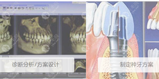 拜博口腔种植牙特色技术 59w.net