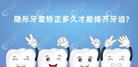 隐形牙套矫正多久才能排齐牙齿?分阶段,正常要6-8个月的时间