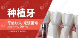 郑州中诺口腔收费价目表:找朱朝黎做种植牙落地价格省1111起