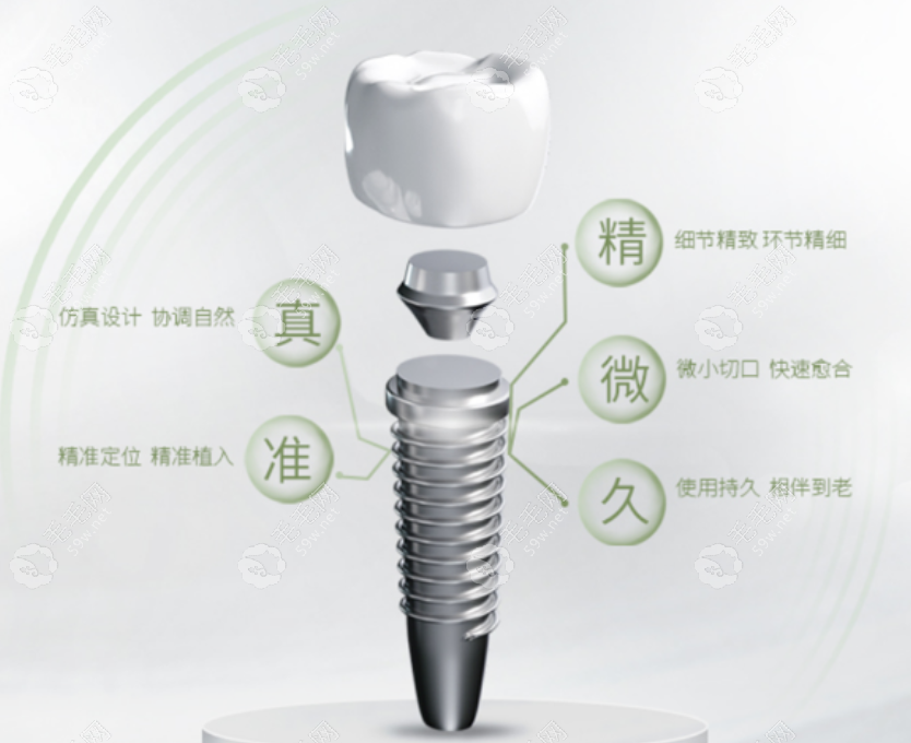 年轻人种植牙结实吗可以用多久?种植牙结实不脱落可用10年+