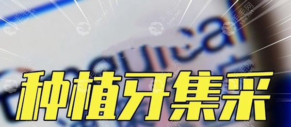 种植牙集采价格表 毛毛网