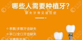 40-50种牙2025价格表：40-50岁种植单颗、多颗和半口牙的人很多