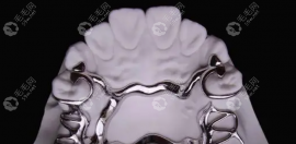 維他靈活動(dòng)牙是什么材質(zhì)的?合金的,與純鈦的性價(jià)比不相上下