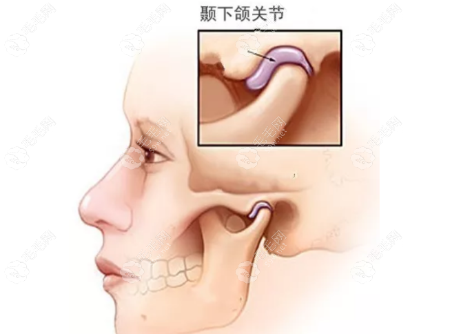 大牙拔除后不种植牙有影响吗?有影响