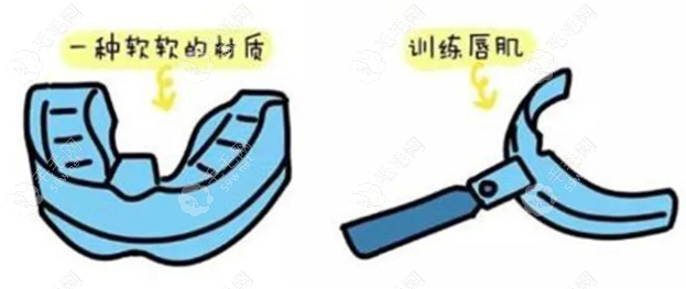 mrc肌功能矫治器的介绍:含mrc早期干预三个阶段及适合年龄