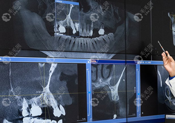 海德堡口腔数字化种植牙 59w.net