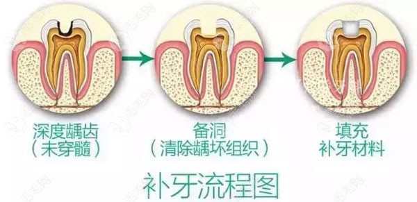 乌鲁木齐市凯乐口腔做补牙能报销