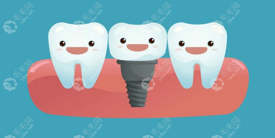 衡阳种植牙多少钱一颗2023年