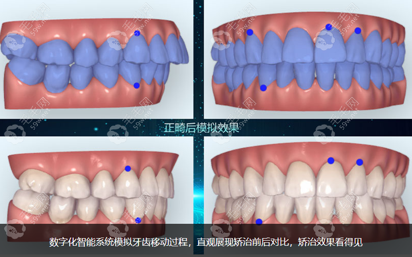 广州德伦数字化正畸技术