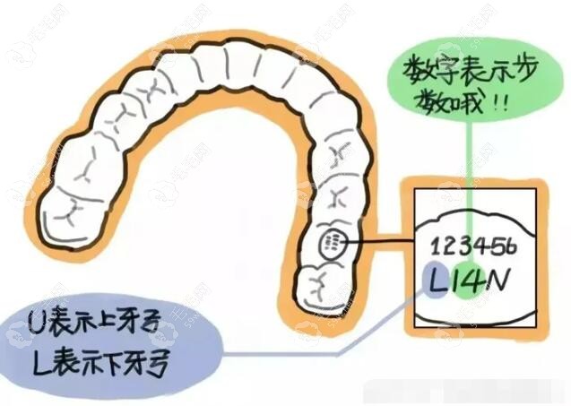 隐适美每副牙套适合戴2周左右www.59w.net