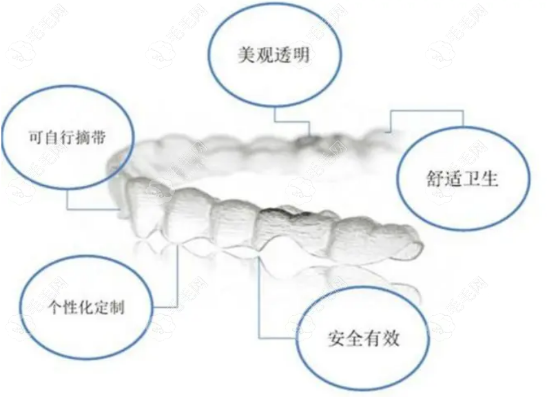 时代天使牙齿矫正详细全过程:1-2周更换牙套,1-3个月有疗效