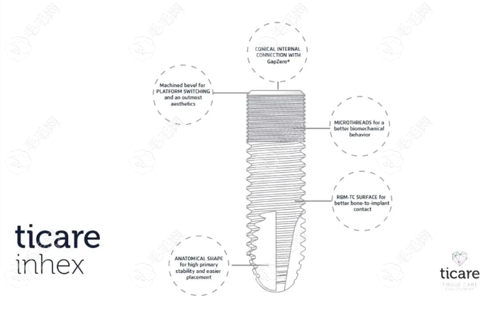 西班牙泰科种植牙质量怎么样?Tcare是4级纯钛材料好,可用10年+