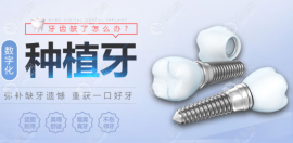广州团圆口腔种植牙价格降了,微创数字化种植牙5480元起一颗