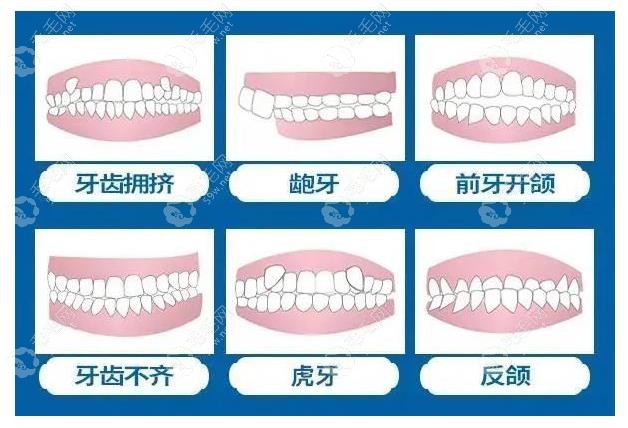 兔博士和小白兔口腔区别在哪里