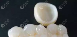 一颗二氧化锆牙500不贵！二氧化锆全瓷牙硬度高更结实