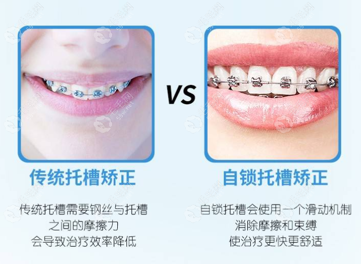 北京好合咔咔口腔数字化正畸好医生周子奇