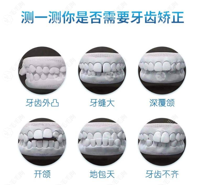 北京好合咔咔口腔成人隐形矫正和儿童早期矫治医生赵艳玲