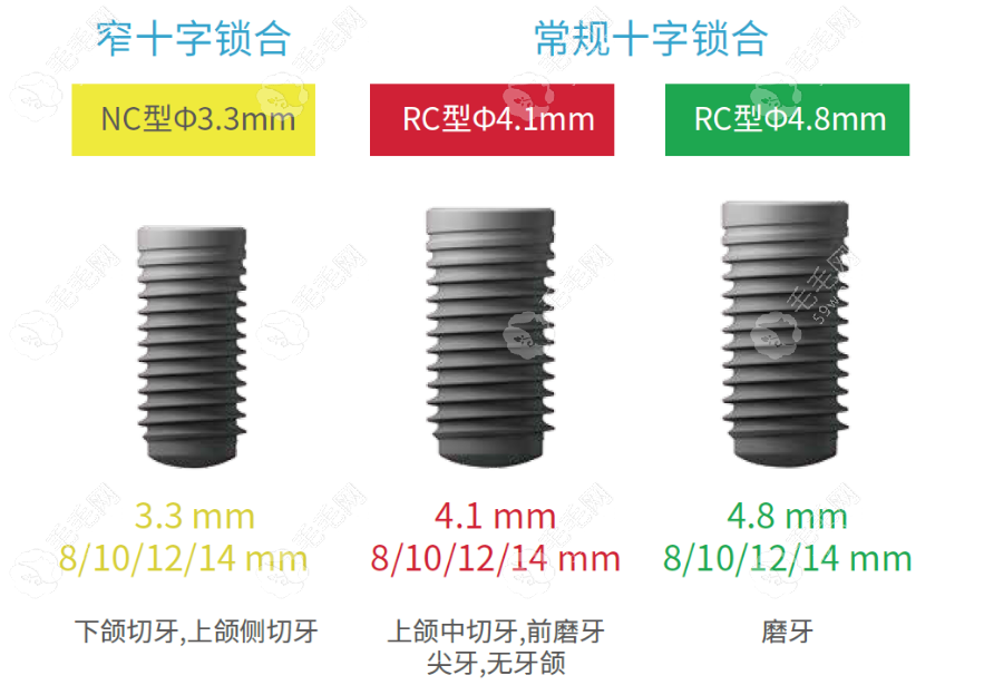 康德泰种植体有什么优点