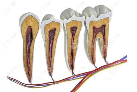 切断牙神经的价格
