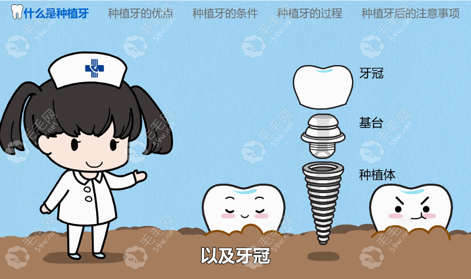 韩国种植牙品牌种植满口牙价格