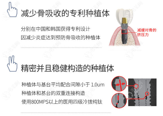 利多齿种植牙口碑怎么样