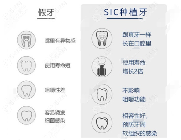 瑞士SIC属于中档次的瑞士植体牌子