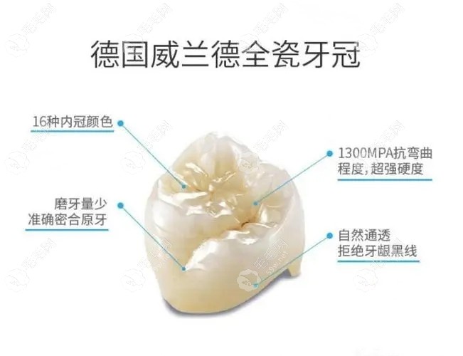 正规医院做的全瓷牙套硬度高崩瓷少