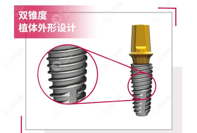 瑞士tplus种植牙质量好