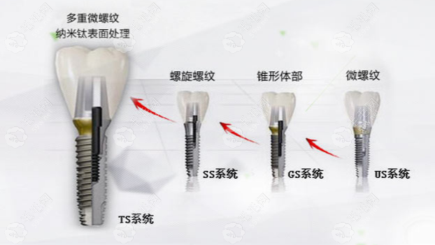 太原达美联合口腔韩国种植牙价格www.59w.net