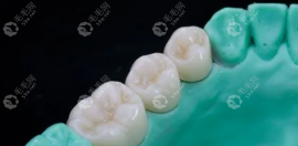 质美全瓷牙哪个国家的?有人说是中国的,这说的对吗？