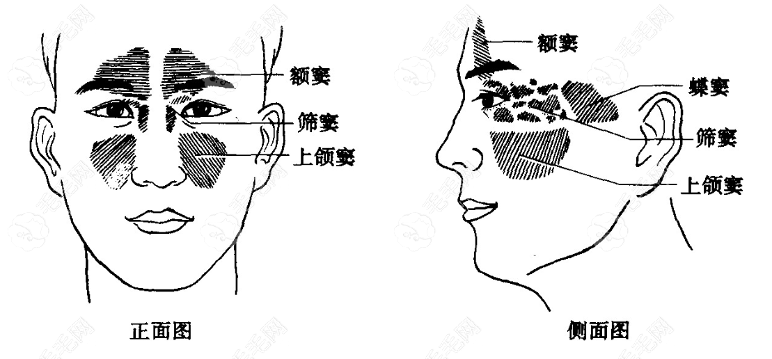 种牙不加骨粉有可能会顶进上颌窦