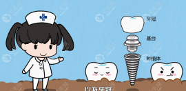 种植牙利与弊有哪些？种植牙利弊解析与规避策略在这里...