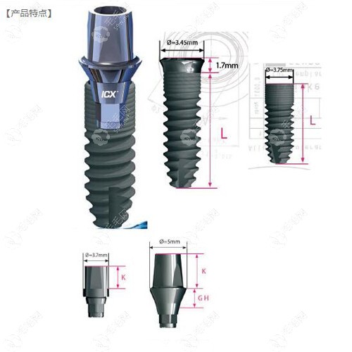 德国icx种植体的材料特质www.59w.net
