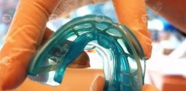 mrc牙齿矫正器一般需戴多长时间?担心戴时间长变成反颌