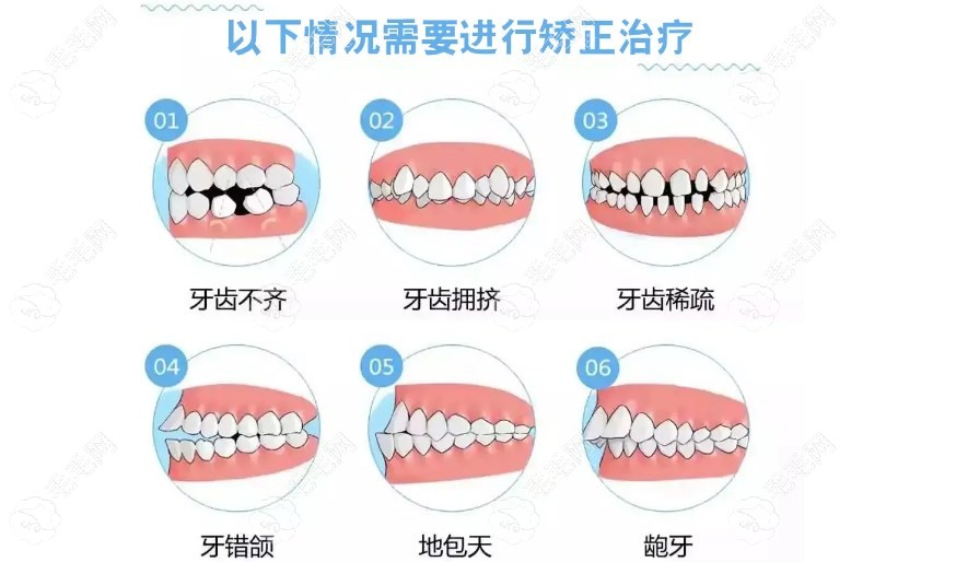 东莞好佰年口腔矫正牙齿靠谱